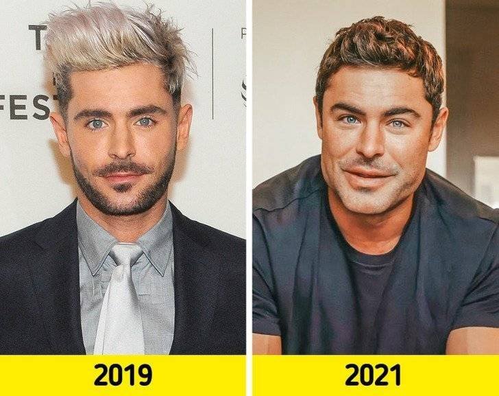 Zac Efron Jawline